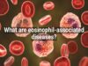 What Are Eosinophil-associated Diseases
