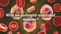What Are Eosinophil-associated Diseases
