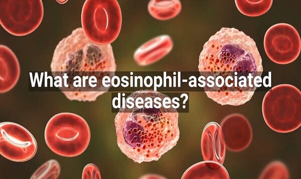 What Are Eosinophil-associated Diseases