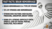 What Is A Brain Hemorrhage
