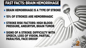 What Is A Brain Hemorrhage