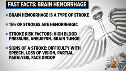 What Is A Brain Hemorrhage