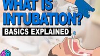 What is Intubation