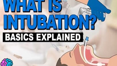 What is Intubation