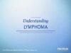 What is Lymphoma