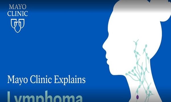 What is Lymphoma.