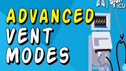 Advanced Vent Modes PRVC APRV HFOV and MORE