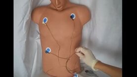 Cardiac Monitor Telemetry Lead Placement