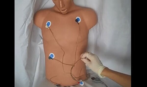 Cardiac Monitor Telemetry Lead Placement