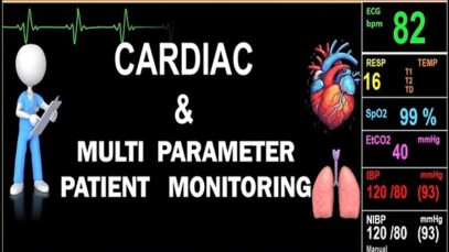 Cardiac Multi parameter patient monitoring in ICU