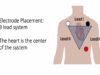 ECG for Nurses 3 5 and 12 Lead Placement electrocardiog