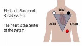 ECG for Nurses 3 5 and 12 Lead Placement electrocardiog