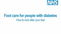 Foot care for people with diabetes How to look after