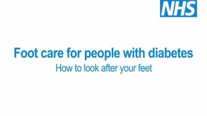 Foot care for people with diabetes How to look after