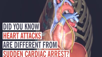 Heart Attack vs Cardiac Arrest What s the Difference