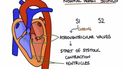 Heart Murmurs and Heart Sounds