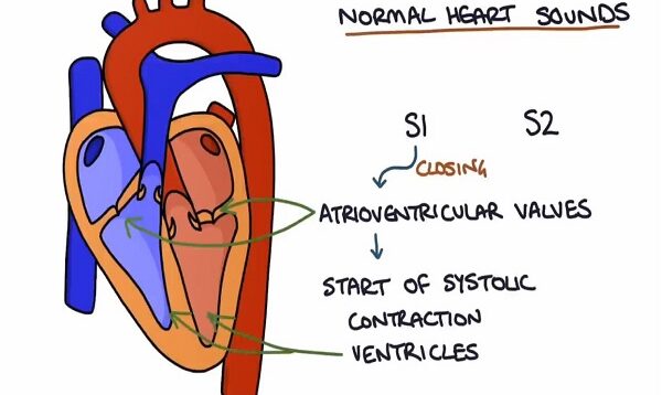 Heart Murmurs and Heart Sounds