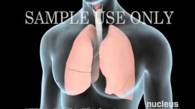 Intubation Mechanical Ventilation Ventilator