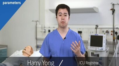 Key settings for a mechanical ventilator