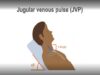 Measuring the jugular venous pulse
