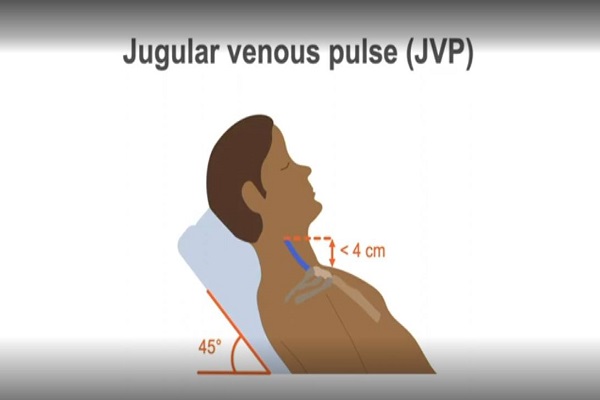 Measuring the jugular venous pulse