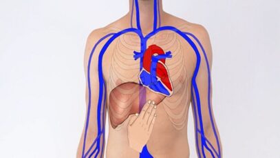 Testing the Hepatojugular Reflux – Clinical Examination