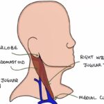 Understanding Jugular Venous Pressure (JVP)