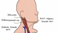 Understanding Jugular Venous Pressure (JVP)