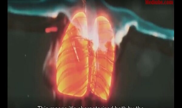 Unraveling BOOP- A Deep Dive into BRONCHIOLITIS OBLITERANS Organ