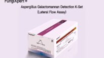 Aspergillus Galactomannan Detection K Set Lateral Flow Assay A