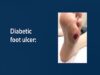 Diabetic Foot Care