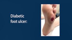 Diabetic Foot Care