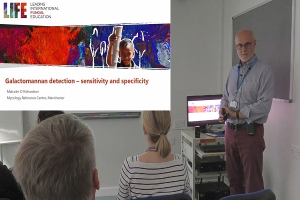 Galactomannan testing or disseminated Aspergillus Talaromyces Histoplasma