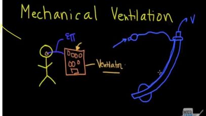 Mechanical Ventilation Explained Clearly Ventilator Set