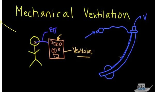 Mechanical Ventilation Explained Clearly Ventilator Set