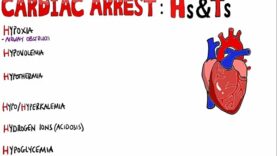 Reversible Causes of Cardiac Arrest Hs and Ts Mnemonic
