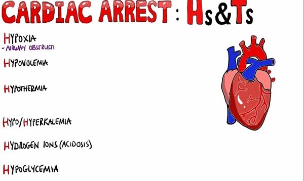 Reversible Causes of Cardiac Arrest Hs and Ts Mnemonic