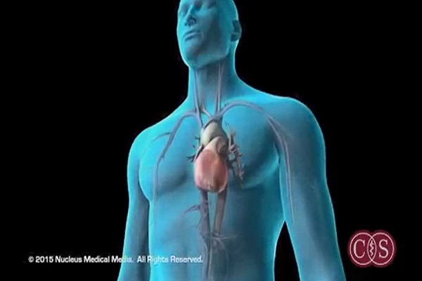 Symptoms of Sudden Cardiac Arrest