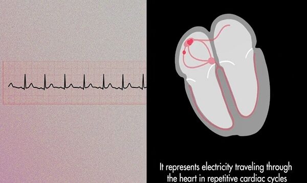 The Cardiac Cycle on an EKG P QRS T Waves