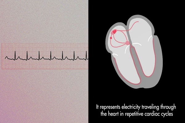 The Cardiac Cycle on an EKG P QRS T Waves