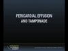 Ultrasound Podcast PERICARDIAL TAMPONADE LEARN THIS