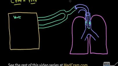 Ventilator Modes Explained PEEP CPAP Pressure vs Volum iP