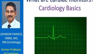 What are cardiac monitors Cardiology Basics