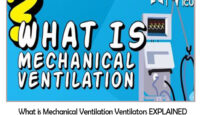 What is Mechanical Ventilation Ventilators EXPLAINED