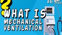 What is Mechanical Ventilation Ventilators EXPLAINED