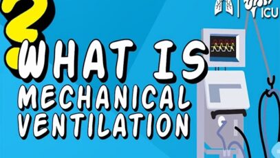 What is Mechanical Ventilation Ventilators EXPLAINED