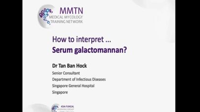 How to interpret serum galactomannan