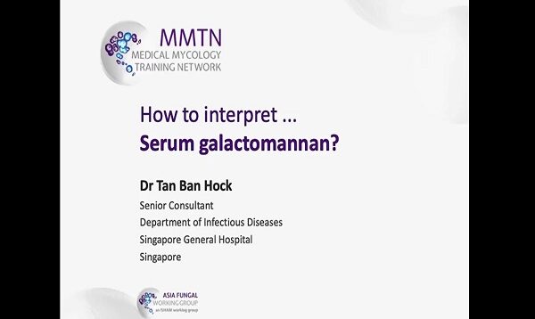 How to interpret serum galactomannan