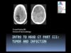 Intro to Head CT Part III_ Tumor and Infection