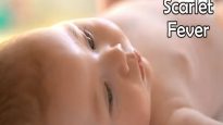 Scarlet Fever Symptoms, Treatment, and Causes